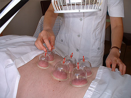 moxibustion3